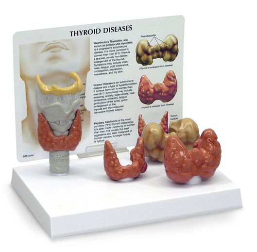 Nasco Nasco Thyroid Model - SB46541