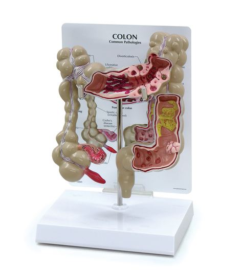 Nasco Nasco Colon Model - SB35434