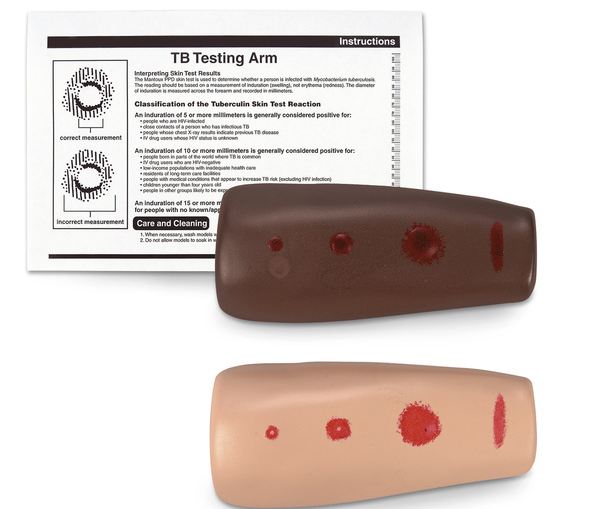 Nasco Simlab TB Testing Arm - SB25973