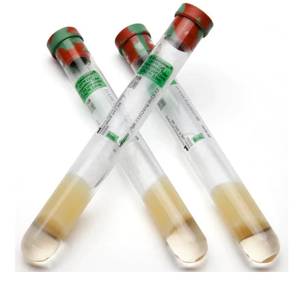 BD Vacutainer CPT - Molecular Diagnostic Tube Cell Preparation Sodium Heparin / Separator Gel Additive 16 X 125 mm 8 mL Green / Red Mottled Conventional Closure Glass Tube - 1495951D