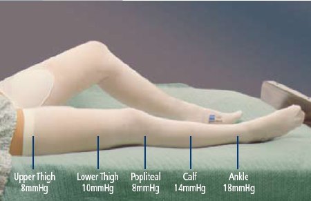 T.E.D. - Anti-embolism Stocking Knee High 2X-Large / Regular White Inspection Toe - 7470LF