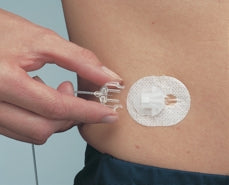 Medtronic SilhouetteParadigm Insulin Infusion Set 17 mm 43 Inch Tubing Without Port - T-371