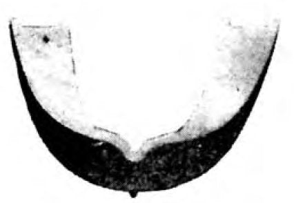 Gardent - Teeth Guard Plastic White - 1081213