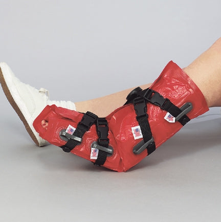 Microtek Medical EMS Immobile-Vac Wrist / Elbow / Ankle Splint Inflatable General Use Red - 81-A2010