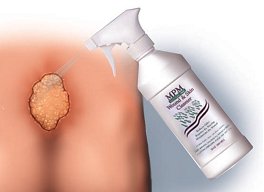 MPM Medical Wound Cleanser 8 oz. Spray Bottle - P00031