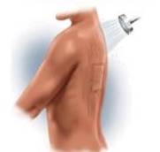 MPM Medical Repel Composite Dressing Composite Dressing 4 X 4 Inch Sterile - P00082