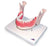 Nasco Healthcare - Dental Disease Teeth Model Adult - SB41498