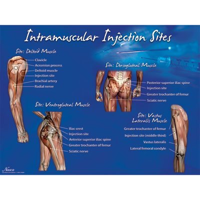 Nasco Healthcare - Educational Poster Intramuscular Injection Sites Training Poster 18 X 24 Inch Heavy Paper Grommets Laminated - LF00695