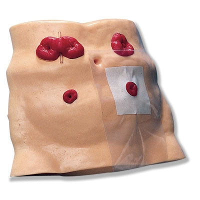 Nasco Healthcare - Ostomy Care Model Synthetic Tissue - SB23501