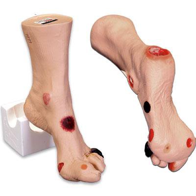 Nasco Healthcare - Wilma Wound Foot - SB46503