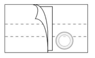 Nu-Form - Peristomal Hernia Belt 2X-Large 8 Inch Width - 6354-C