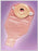 Nu-Flex Nu-Comfort - Post-Op Ostomy Pouch Two-Piece System Drainable Deep Convex, Trim to Fit - 40-7203-DC