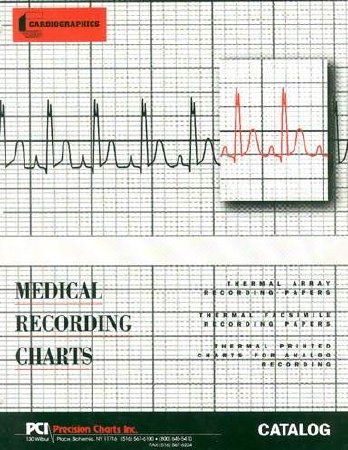 Philips - Diagnostic Recording Paper Thermal Paper 50 mm X 100 Foot Roll Black Grid - 9270-0980