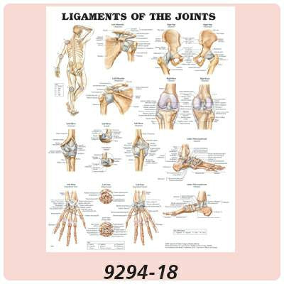 Patterson Medical Supply - Anatomical Chart Understanding Arthritis 20 X 26 Inch Plastic Grommets Laminated - 558376