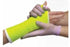 Delta-Lite Conformable - Cast Tape 4 Inch X 12 Foot Fiberglass Neon Pink - 6054