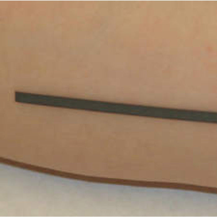 Precision Dynamics MARKER, SKIN INDICATOR RADIOPAQUE 1.5MM (125/BX) - SDW-CT15