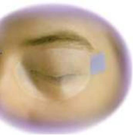 EyeGard - Eye Protector Adult Tabs - S2020