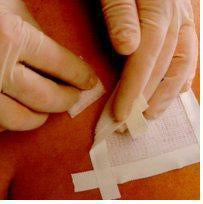 Smith & Nephew Remove Adhesive r Liquid 8 oz. - 403300