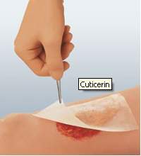 Cuticerin - Oil Emulsion Impregnated Dressing 8 X 16 Inch Acetate Gauze Ointment Sterile - 66045502