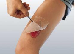 Cuticerin - Oil Emulsion Impregnated Dressing 3 X 8 Inch Acetate Gauze Ointment Sterile - 66045563