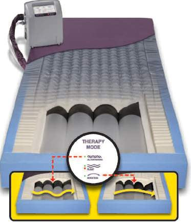 Alternating Pressure Mattress