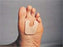 Pedifix Pedifix Callus Protector Cushion Without Closure Foot - P16