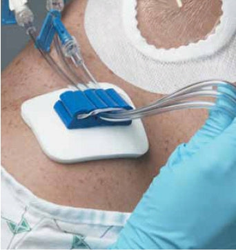 Medline - Tubing Anchor - ANC32XT