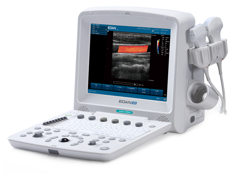 EDAN U50 Prime Ultrasound
