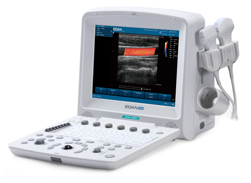 Edan - Ultrasound Probe 2.5 / 3.5 / 4.5 / H2.5 / H2.7MHz, 128 elements - C352UB