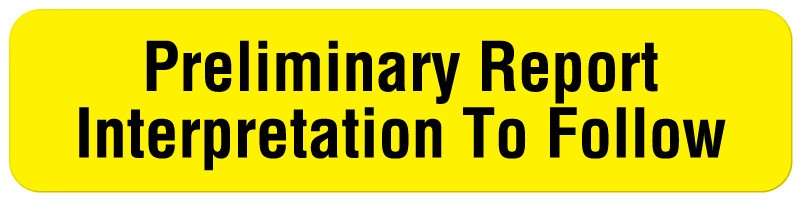 Medical Labels - Cardiopulmonary Department Label, 1-5/8" x 3/8"