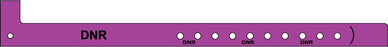 Medical Labels - Adult Patient Identification Plastic Alert Band, 11" x 5/8"