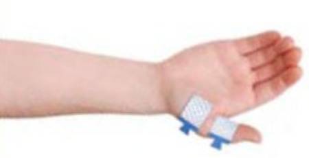 Natus - EMG Adhesive Electrode Kit Silver / Silver Chloride Sterile Bar Tab / Ring Tab / Ground Tab Tip Disposable - N2025