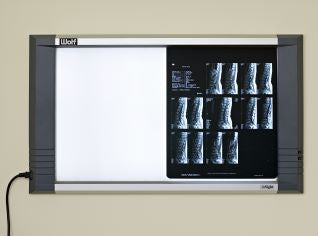 Wolf X-Ray Insight Series X-Ray Illuminator 2 Bank 1 Tier Wall Mount / Desk Stand / VESA Arm - 27002