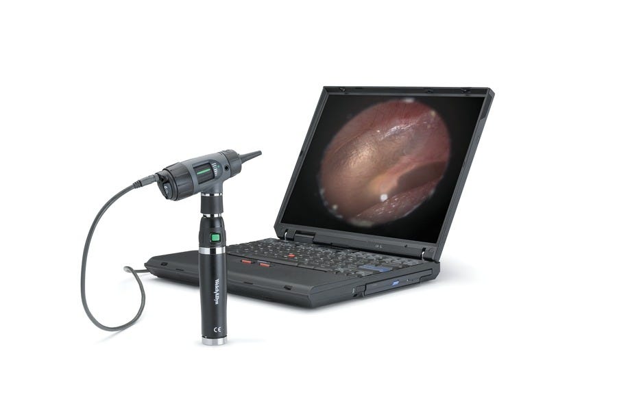Welch Allyn Digital MacroView 3.5 V Halogen HPX Fiber-Optic Otoscope - 23920