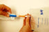 Urethral Catheter