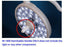 Symmetry Surgical - Sterilisable Handle For M1 1000 Major Surgical Light - BV-1000616