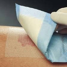 Non-Adherent Dressings