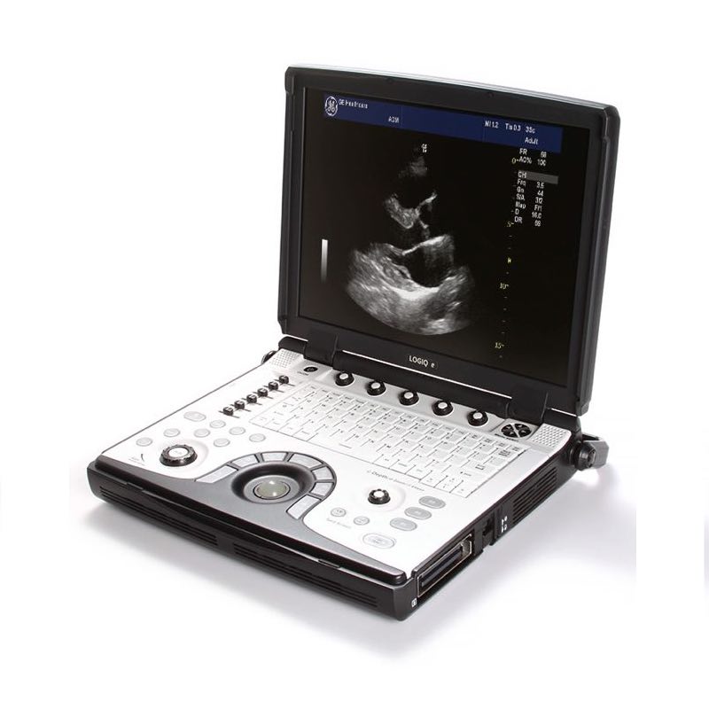 Logiq Ultrasound System