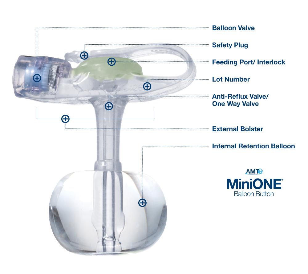 Applied Medical Technologies MiniONE Low Profile Balloon Button Gastrostomy Tube 18 Fr. 4.4 cm Silicone - 1-5-1844-I