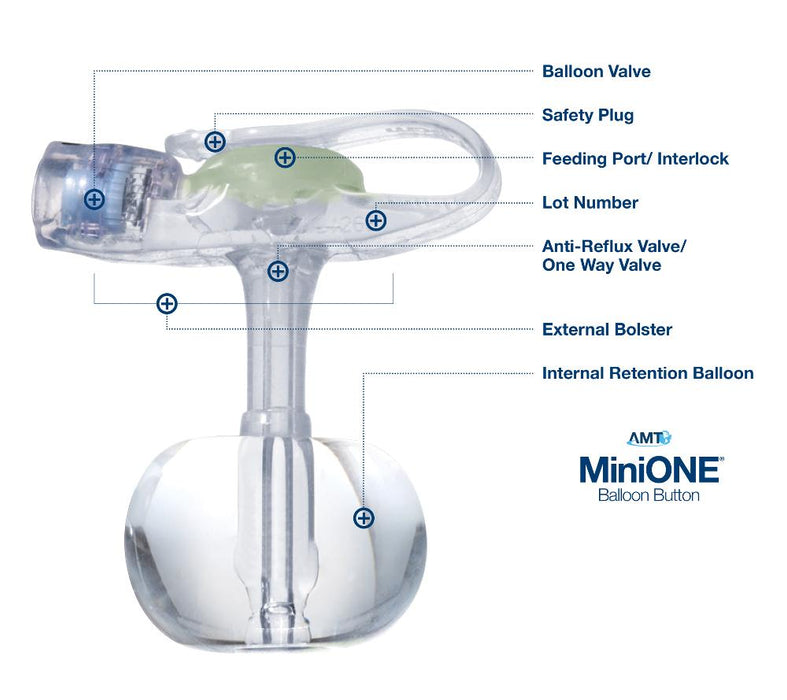 Applied Medical Technologies MiniONE Low Profile Balloon Button Gastrostomy Tube 18 Fr. 4.4 cm Silicone - 1-5-1844-I