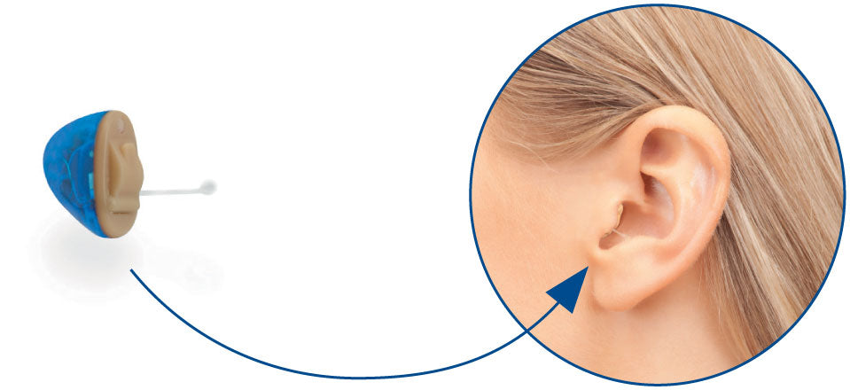 Gohear Hearing Aid