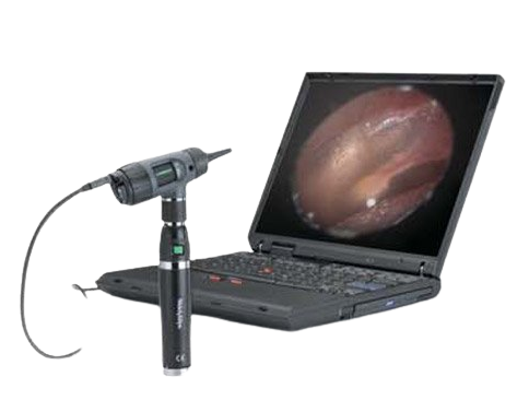 Welch Allyn MacroViewâ„¢ Otoscope with Throat Illuminator - 23820
