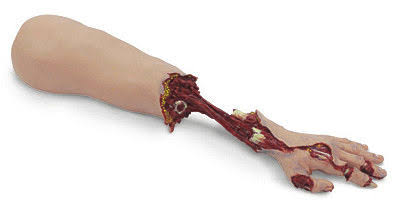 Left Trauma Bleeding Arm