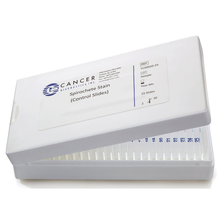 Cancer Diagnostics SLIDE, AMYLOID CONTROL (20/BX) - HCS1005