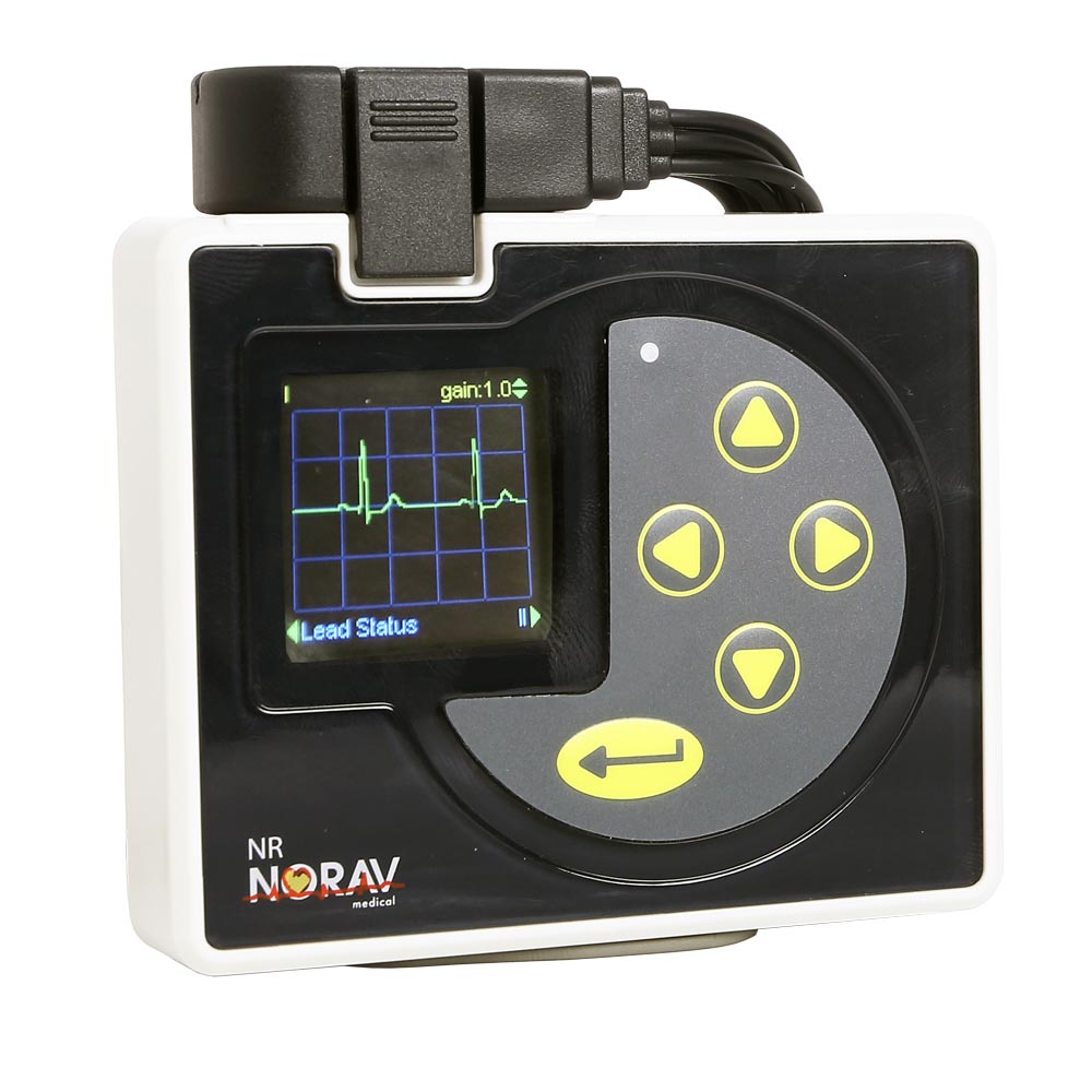 Wireless Mobile ECG