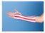 Tubular Elastic Retainer Dressing