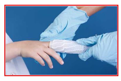 Tubular Gauze