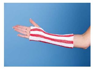 Tubular Elastic Retainer Dressing