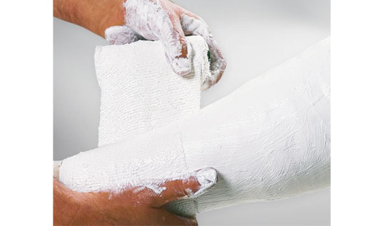 Lohmann & Rauscher Cellona Plaster Bandage 6 Inch X 9 Foot Plaster White - 91384