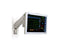 Vital Signs Monitor